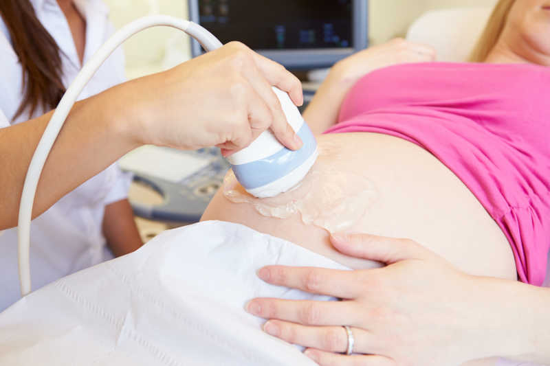 超声扫描孕妇肚子的仪器
