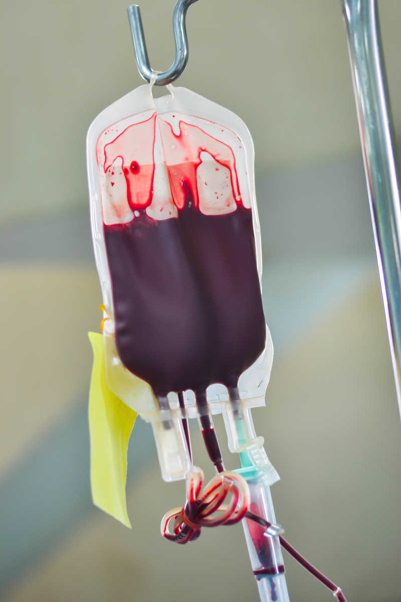 输血袋真实图片图片