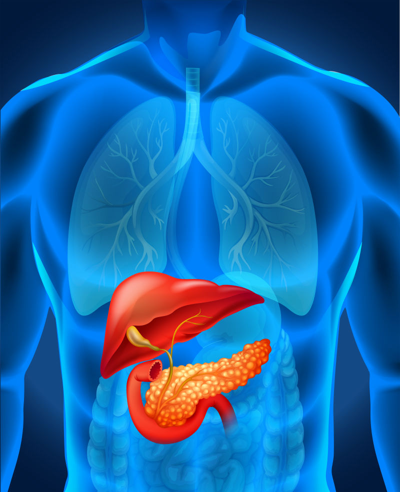 抽象人体胰腺癌的矢量插图