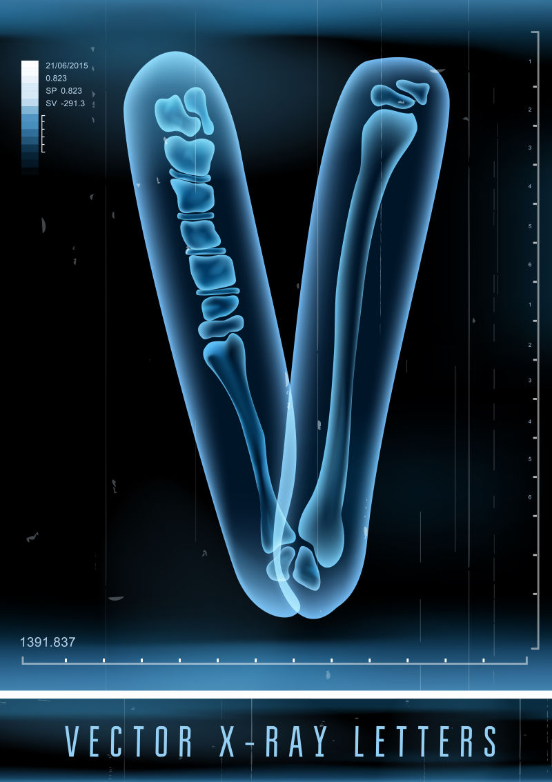 X射线矢量透明字母V