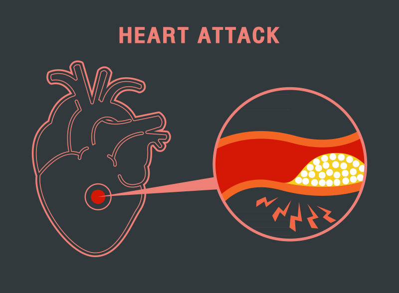 创意矢量心脏健康警报主题海报设计