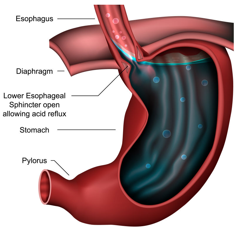 食管括约肌解剖回流三维医学矢量图