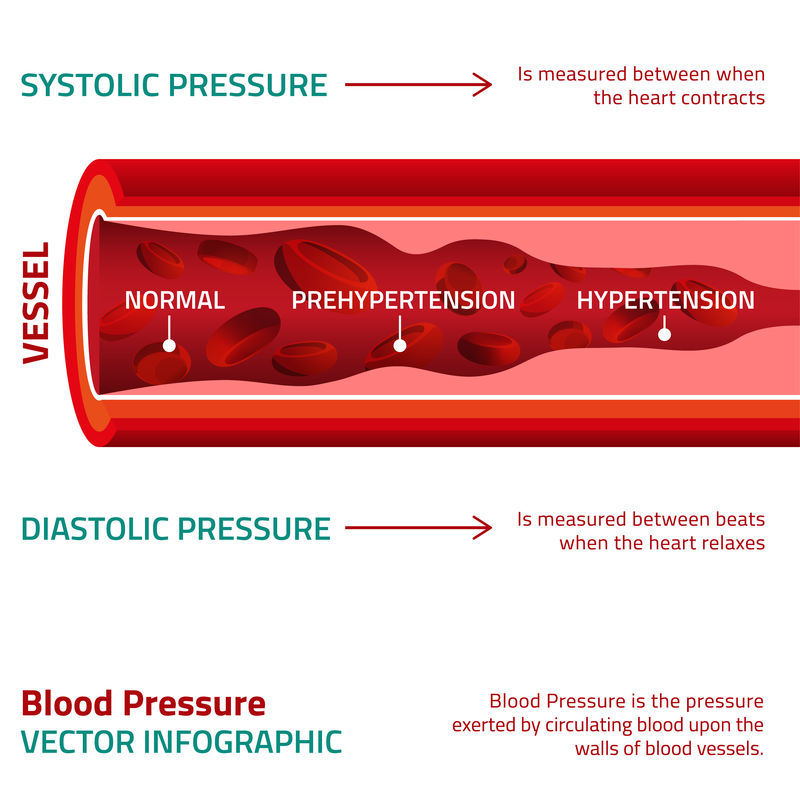 血压信息图