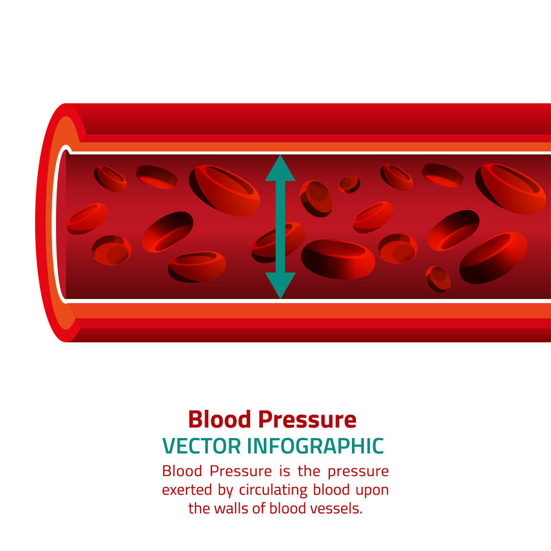 血压信息图