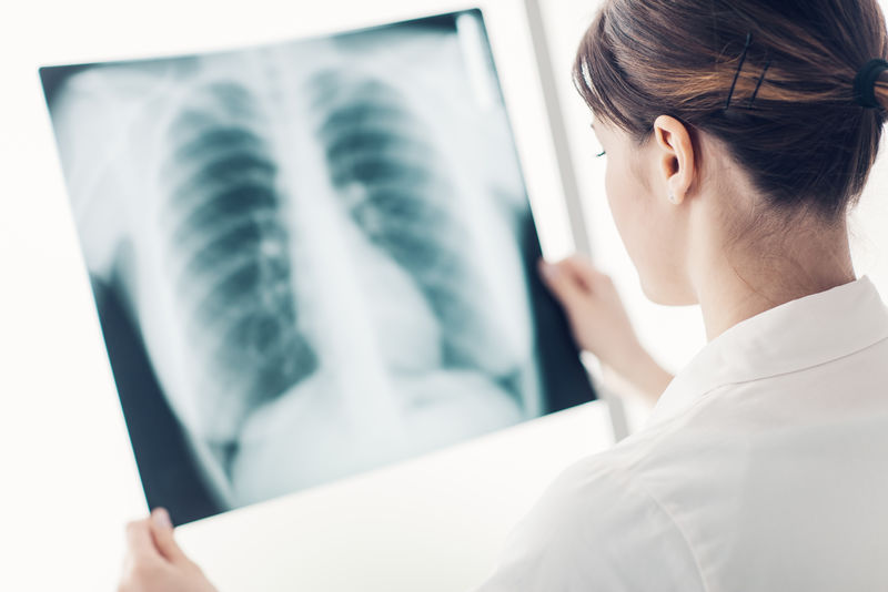 女医生为病人检查肺部和胸腔的x光片、放射学和保健概念