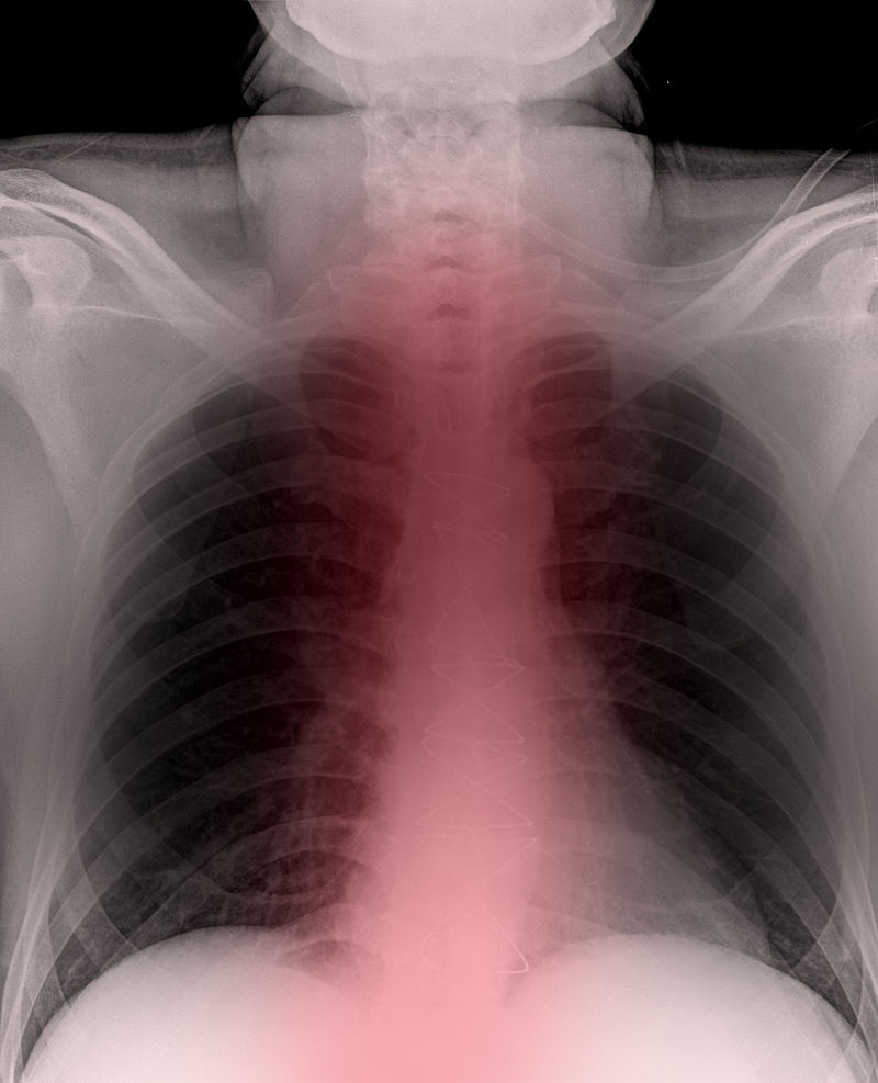 X射线下的身体骨骼