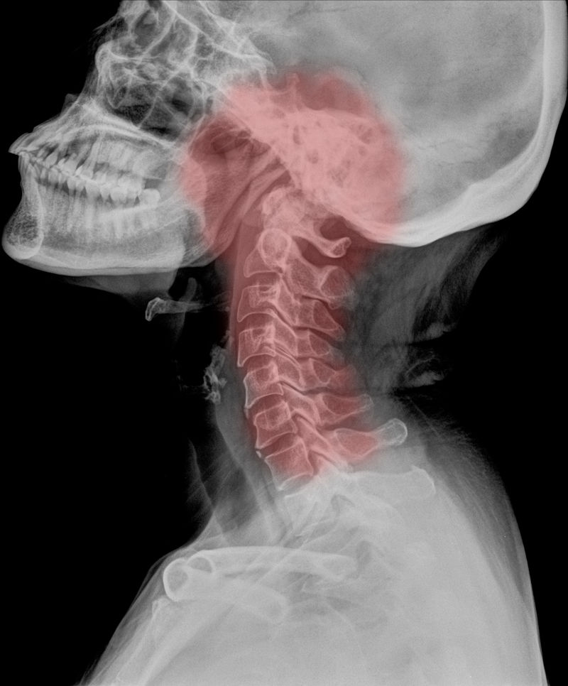 X射线下的身体骨骼