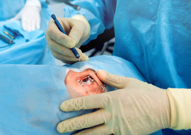 为病人做眼科手术的医生