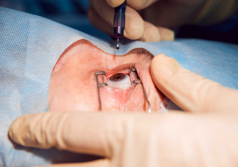 病人正在做眼睛手术
